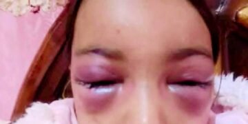 مرآة اب مجردة من الرحمة تتعدى على طفلين بالضرب المبربالشرقية