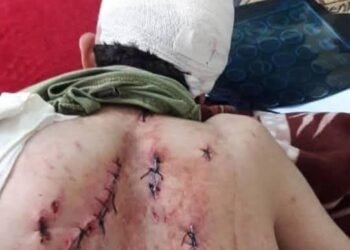 واقعة مؤسفة في ملاهي “لونا بارك” في بورسعيد شاب يتعرض لاعتداء وحشي من البلطجية بسبب دفاعه عن اخته من التحرش