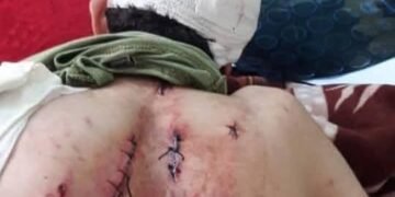 واقعة مؤسفة في ملاهي “لونا بارك” في بورسعيد شاب يتعرض لاعتداء وحشي من البلطجية بسبب دفاعه عن اخته من التحرش